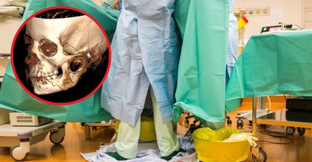 7-latka nie mogła otwierać ust. Ogromny guz pojawił się w nietypowym miejscu
