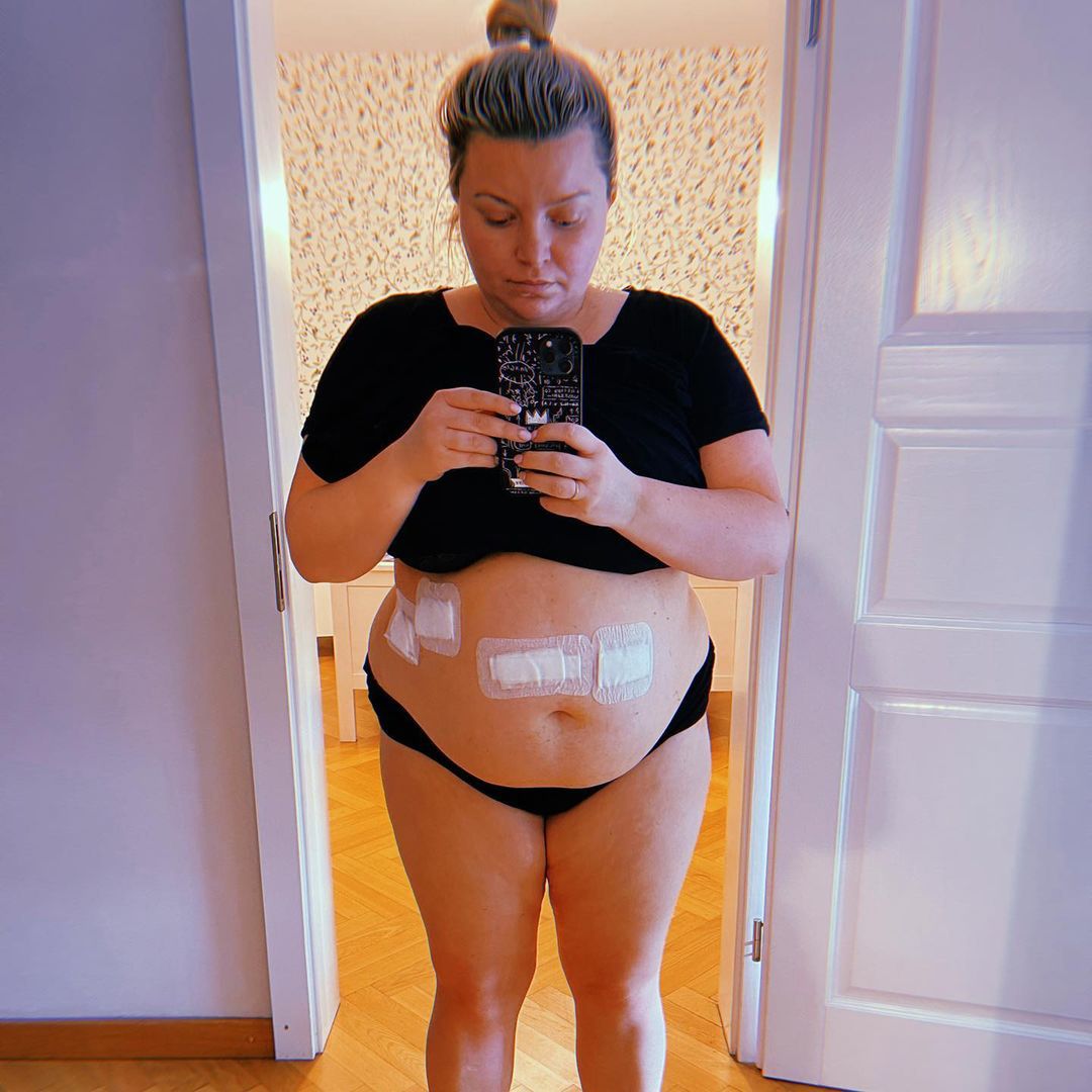 Justyna Mazur udzieliła wywiadu. Opowiedziała o walce z otyłością, hejcie i operacji