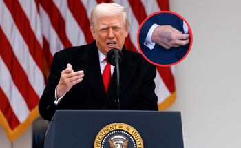 Siniaki na dłoniach Trumpa. Zaskakujące tłumaczenie prezydenta