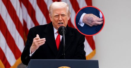 Siniaki na dłoniach Trumpa. Zaskakujące tłumaczenie prezydenta