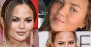 Chrissy Teigen: "Wszystko we mnie jest sztuczne. Odessałam nawet tłuszcz spod pachy"