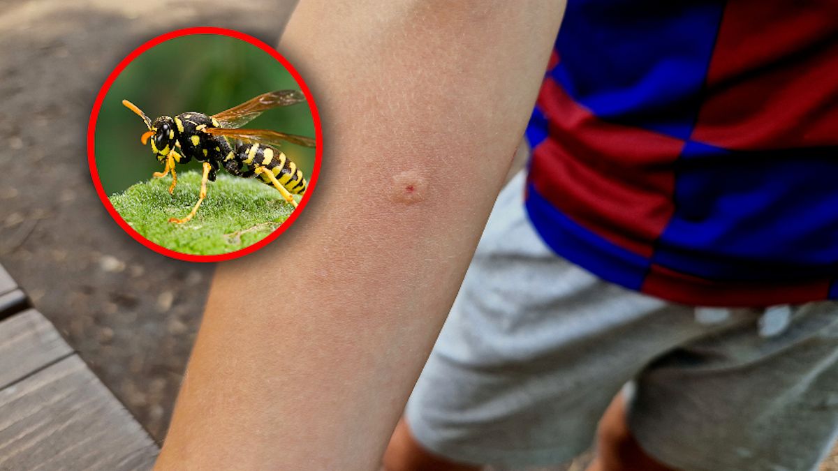 Niebezpieczne spotkanie z szerszeniem, osą i pszczołą. Ukąszenie może wywołać wstrząs anafilaktyczny
