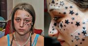 Belgijka wytatuowała sobie na twarzy 56 gwiazdek. Na ich usunięcie wdała ponad 60 tysięcy złotych. Dziś jest nie do poznania (ZDJĘCIA)