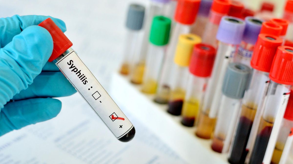 Kiła jest lekceważona, ale coraz bardziej się rozprzestrzenia