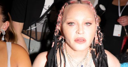 Madonna trafiła na intensywną terapię. "Poważna infekcja bakteryjna"