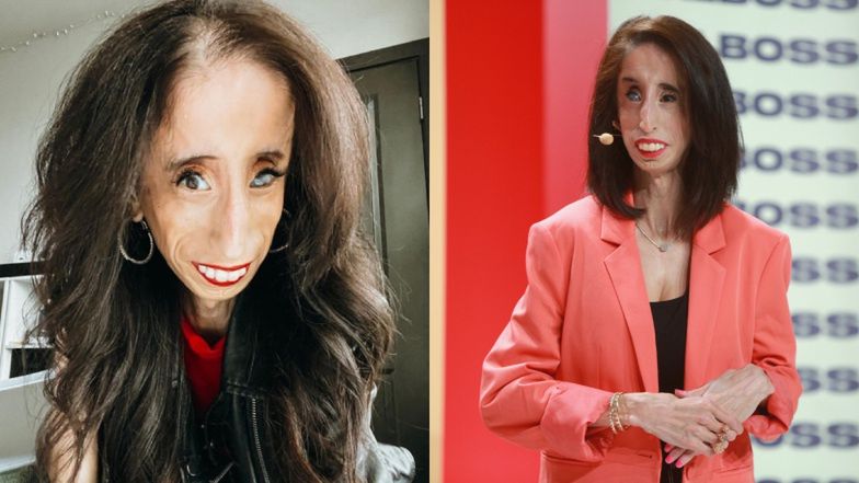 Okrzyknięto ją "najbrzydszą kobietą na świecie". Dziś Lizzie Velasquez motywuje innych 