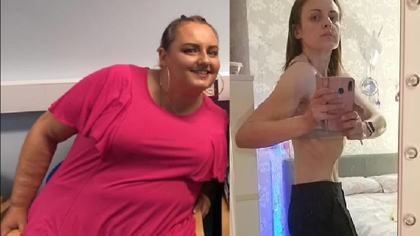 Od otyłości do anoreksji w 15 miesięcy. Kobieta schudła prawie 80 kg