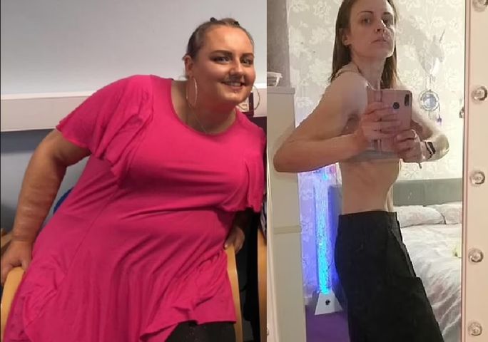 Od otyłości do anoreksji w 15 miesięcy. Kobieta schudła prawie 80 kg
