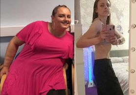 Od otyłości do anoreksji w 15 miesięcy. "Groziła mi sepsa. Uratował mnie lockdown"