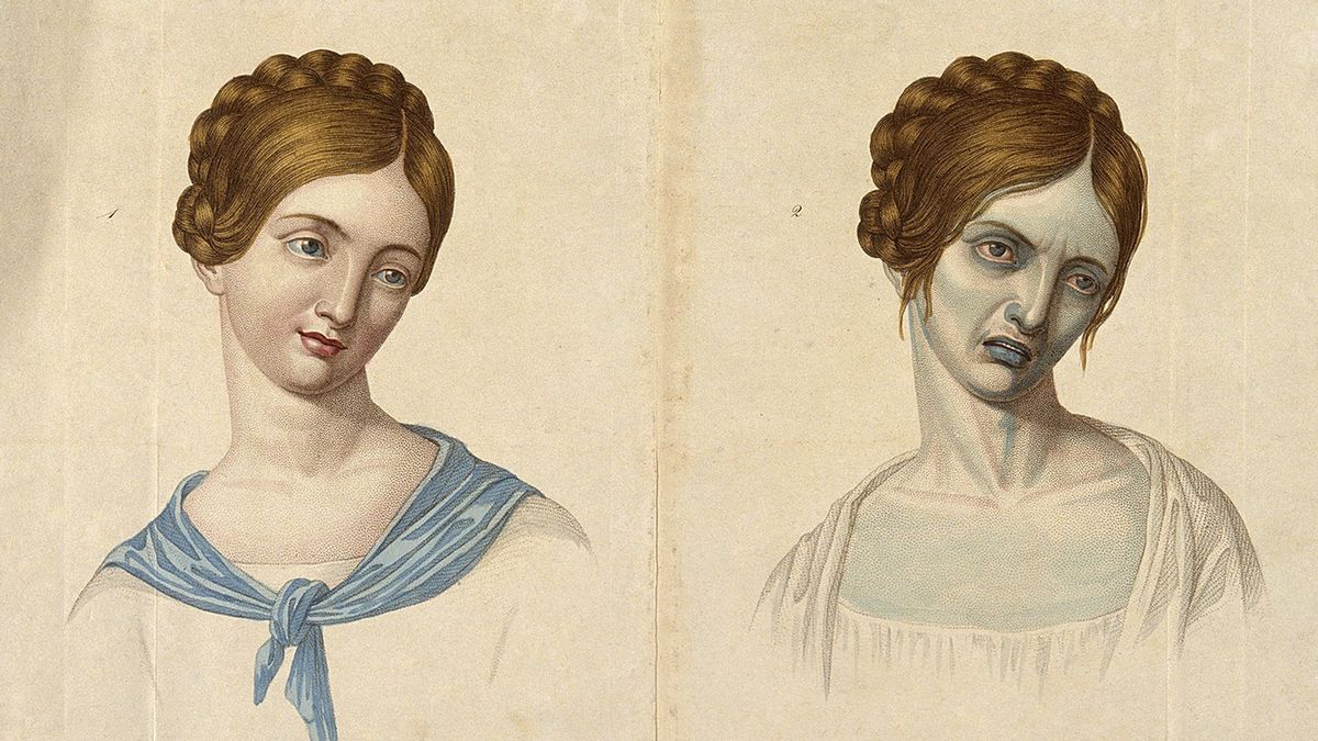 Epidemie cholery w XIX-wiecznej Polsce. Zapomniana choroba zabiła setki tysięcy ludzi