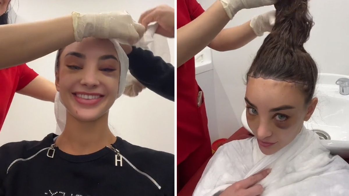 Poleciała do Turcji żeby poddać sięoperacji