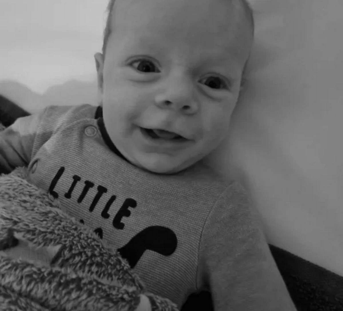 Lekarze myśleli, że to alergia. Tak u niemowlaka objawiał się guz mózgu