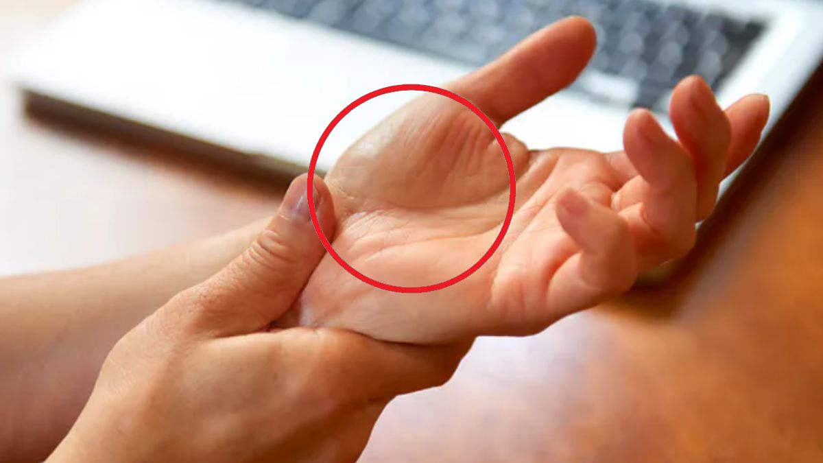 Co oznacza tzw. pierścień saturna?