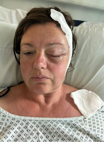 Shelley Whittaker po operacji