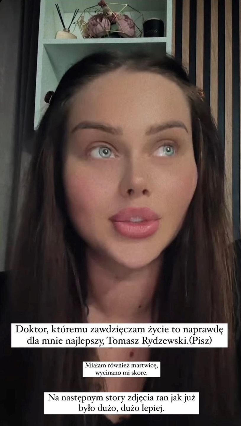Ewel0na o przerażających komplikacjach po operacji w Turcji