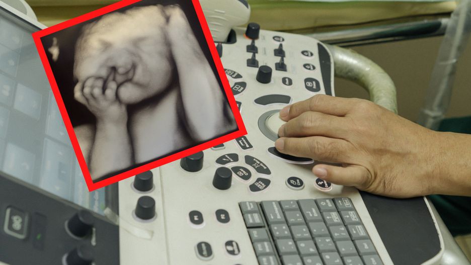 W ciąży dowiedziała się, że jej syn przyjdzie na świat z rozszczepem wargi