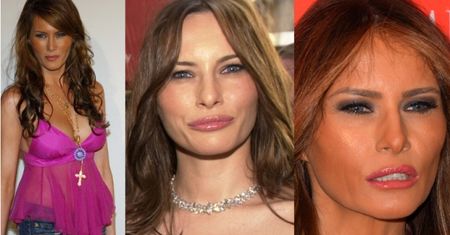 Melania Trump o operacjach plastycznych: "NICZEGO NIE ROBIŁAM! Prowadzę zdrowy tryb życia"