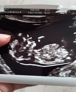 "Jestem jedną z ostatnich kobiet, które miały legalną aborcję". Tak wygląda zabieg