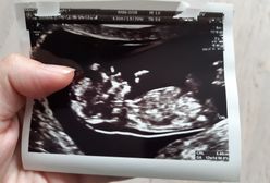 "Jestem jedną z ostatnich kobiet, które miały legalną aborcję". Tak wygląda zabieg