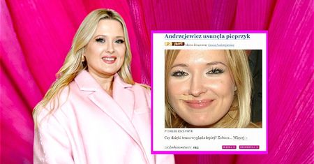#18 lat temu na Pudelku: Gosia Andrzejewicz usunęła sobie PIEPRZYK!