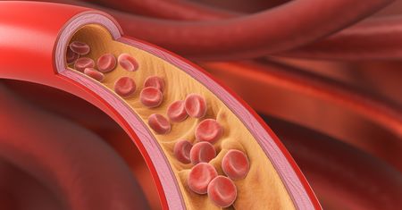 Hipercholesterolemia na talerzu: co naprawdę zmienia dietę?
