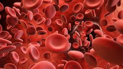 MCV - charakterystyka, normy