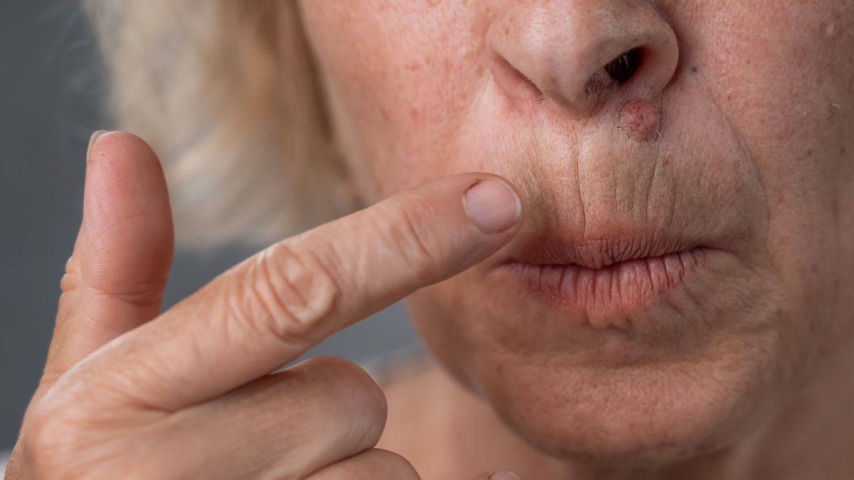 Jak uporać się ze zmarszczkami?