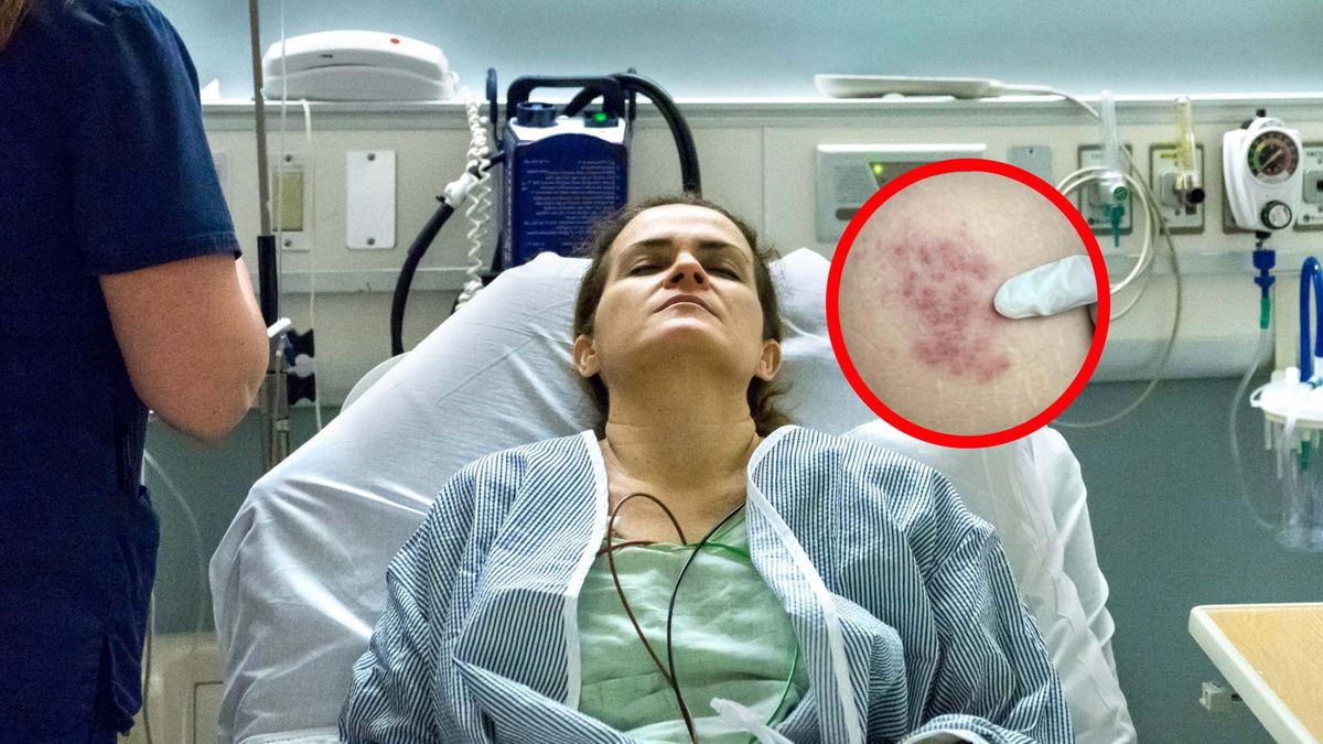 Impulsem do uaktywnienia wirusa może być stres