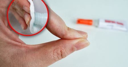 Jak usunąć klej ze skóry? Tego sposobu nie znałeś