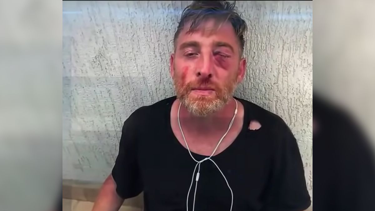 Fotorepoterzy zaatakowani podczas protestu anty-LGBT. 1 osoba nie żyje 1