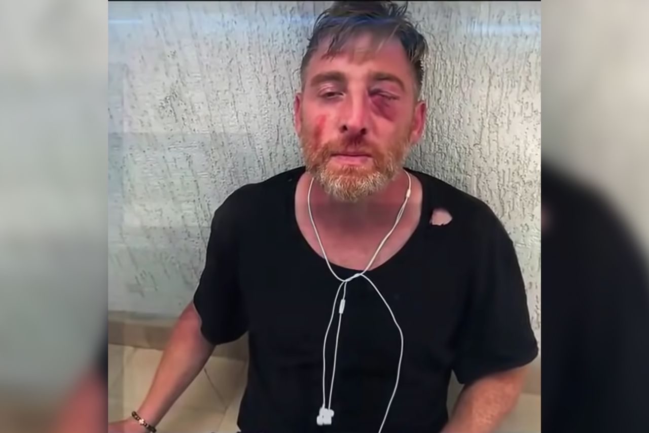 Fotorepoterzy zaatakowani podczas protestu anty-LGBT. 1 osoba nie żyje