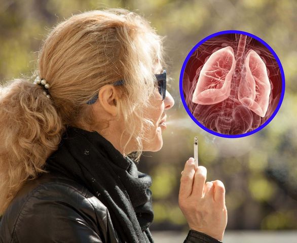 Powoduje w płucach większe szkody niż papierosy. Niszczy pęcherzyki i prowadzi do rozedmy