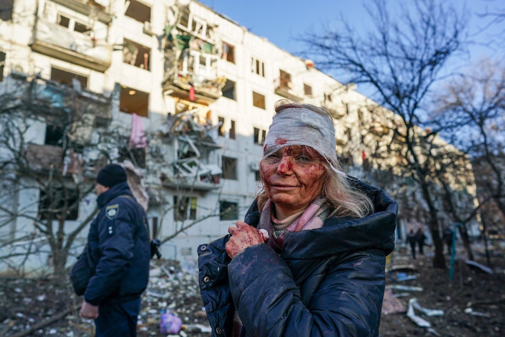 52-letnia mieszkanka Czuhujewa została ranna w jednym z rosyjskich nalotów