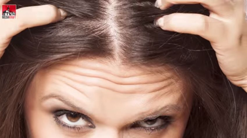 Dlaczego wypadają nam włosy? (WIDEO)