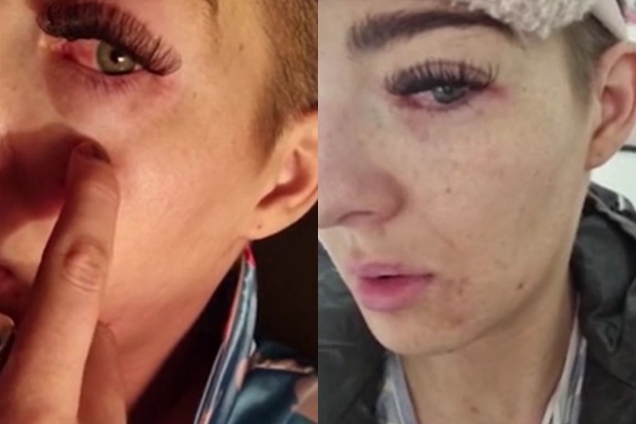 Jessica długo walczyła ze skutkami zabiegu