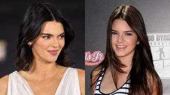 Kendall Jenner twierdzi, że nie miała żadnej operacji plastycznej i zapewnia, że LEK NA TRĄDZIK ZMNIEJSZYŁ JEJ NOS. Wierzycie?