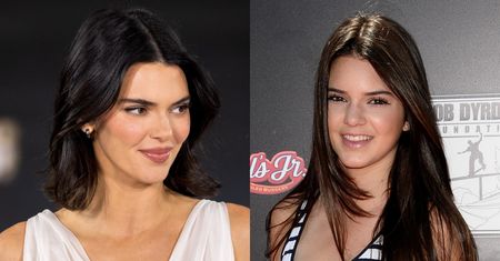 Kendall Jenner twierdzi, że nie miała żadnej operacji plastycznej i zapewnia, że LEK NA TRĄDZIK ZMNIEJSZYŁ JEJ NOS. Wierzycie?