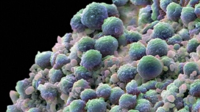 Nowotwory bardziej jak obcy niż jak choroba? 1