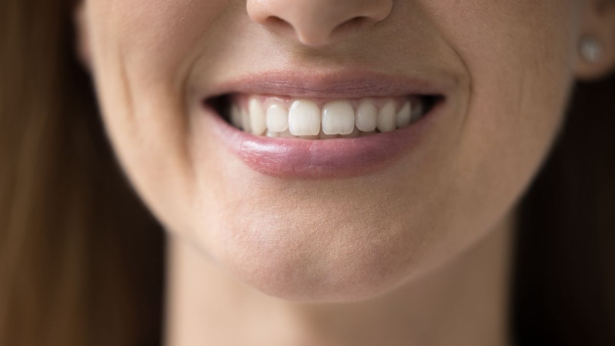 Dr Smile deklarował korektę wad zgryzu nakładkami prostującymi zęby. Zdjęcie ilustracyjne