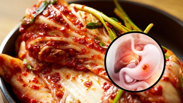 Kimchi zawiera składniki, które moga się przyczynić do raka żołądka