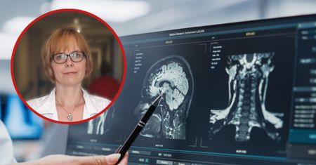 Polska nieprzygotowana na te wyzwania. Neurolodzy alarmują
