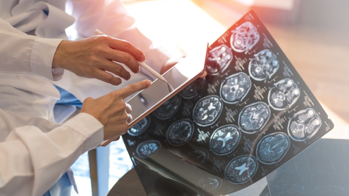 Zaskakujące wyniki badań naukowców dotyczące demencji