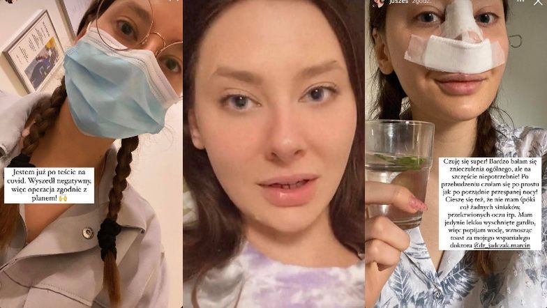 Justyna z "Big Brothera" poddała się operacji plastycznej: "Mój nos jest PORZĄDNIE POKIERESZOWANY" (ZDJĘCIA)