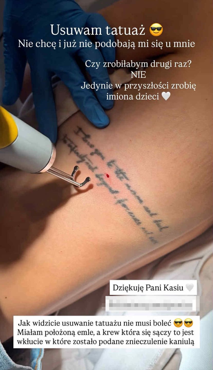 Marcela Leszczak usuwa tatuaż