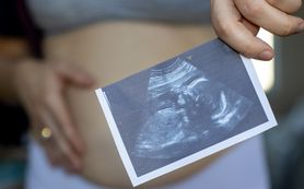 Fetus in fetu – jak rozpoznać bliźniaka pasożytniczego?