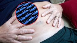 Złośliwy i podstępny rak. Bardzo trudno z nim wygrać