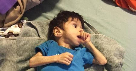 Zaadoptowali 7-latka ważącego 3 kg. Zobacz, jak dzięki nim dziś wygląda