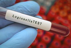 Legionella w Polsce. Władze nie wdrożyły unijnej dyrektywy