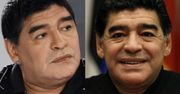 Maradona po OPERACJI PLASTYCZNEJ TWARZY! Poznajecie?