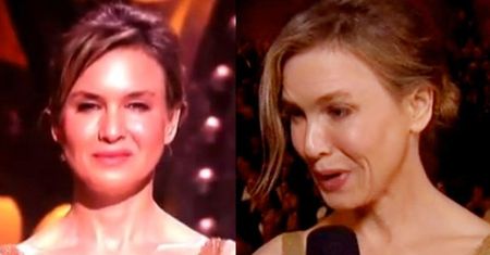 Co się stało z twarzą Renee Zellweger?!